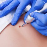 Morrinhos ultrapassa a marca de 1.300 pequenas cirurgias realizadas na atual gestão